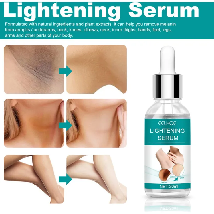 EELHOE Makes Brighter To Your Body And Posture Without Any Side Effect