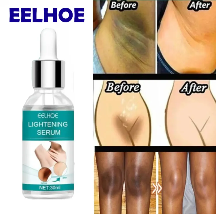 EELHOE Makes Brighter To Your Body And Posture Without Any Side Effect
